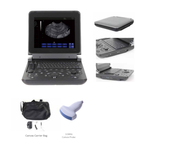 Ultra sound machine
